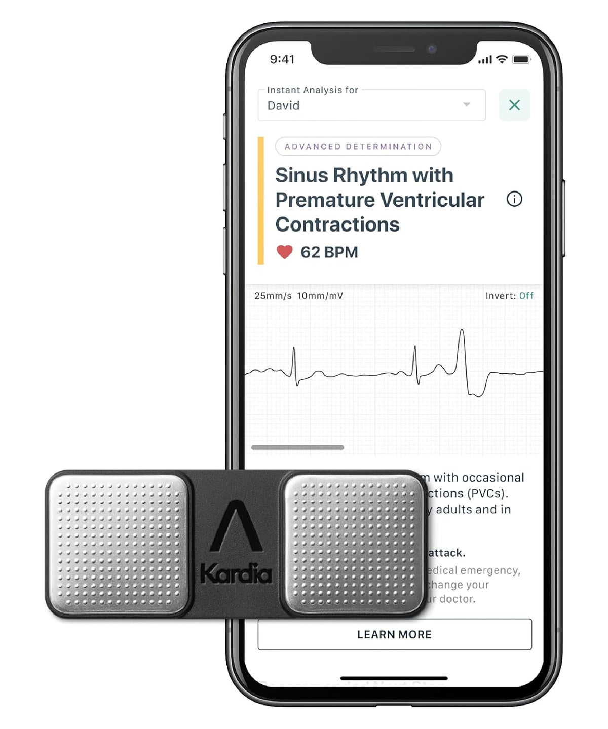 Personal EKG Device and Heart Monitor K586